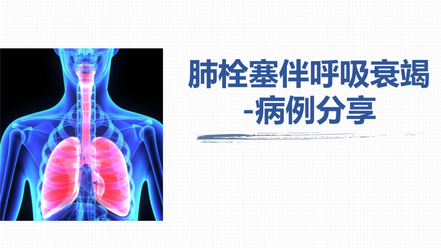肺栓塞引起呼吸衰竭