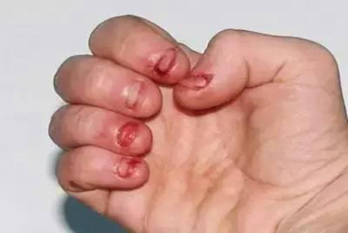 十歲男童咬手指什麼病（十堰一歲男童患怪病）1
