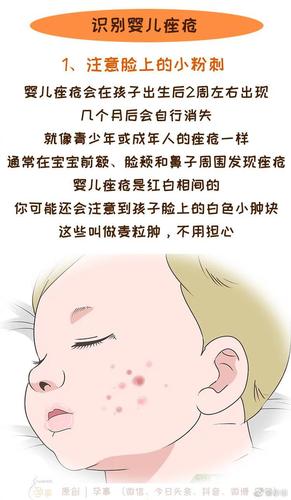 防止小孩長痘痘的方法（簡介防止小孩長痘痘的方法）1