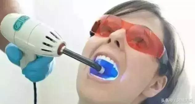 洗過牙之後注意些什麼（這些問題你也不一定清楚）7