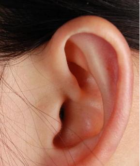 急性中耳炎是由于什麼原因引起的（患急性中耳炎的症狀有哪些）1