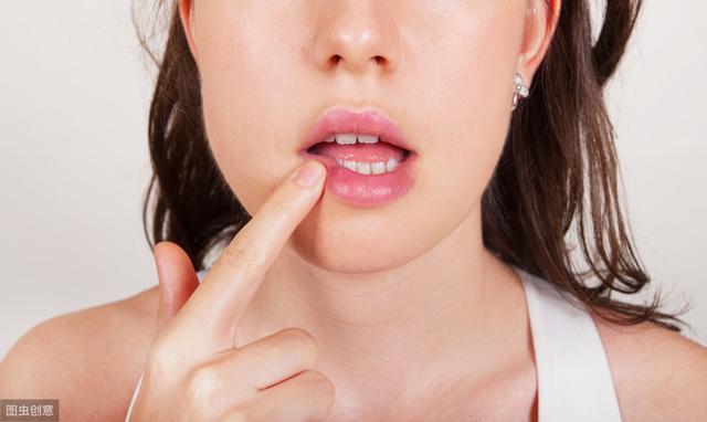 舌頭潰瘍特别嚴重怎麼治療（舌頭潰瘍怎麼辦）3