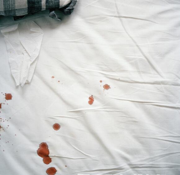 床單上面的血漬有什麼妙招能洗掉（床單衣服上難清理的血漬）1