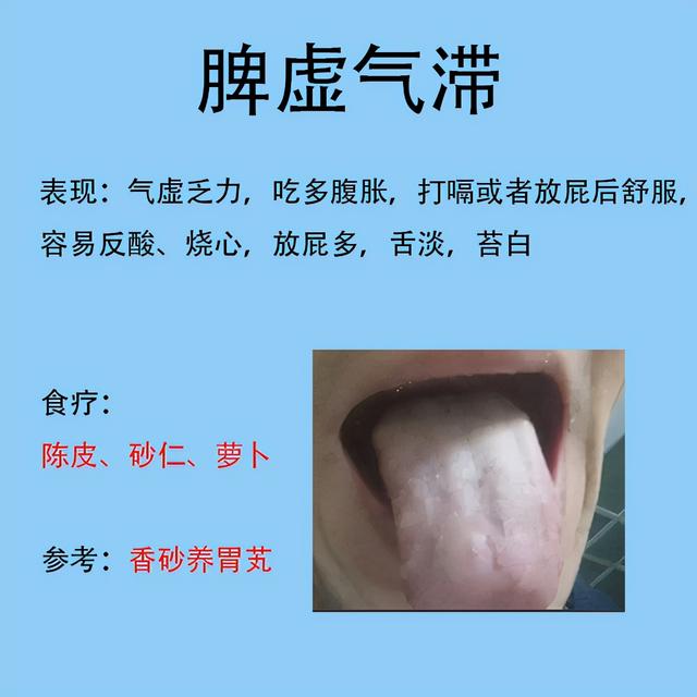舌齒痕脾胃虛弱舌象圖（脾胃不好常見的六種舌象）2