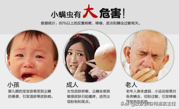 上海硫磺皂的作用去螨蟲（3元一塊的硫磺皂洗臉去螨蟲）4