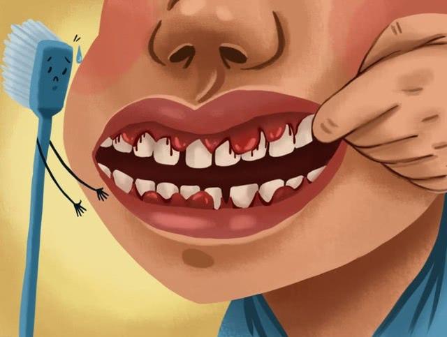 牙龈總是出血是什麼毛病（或是身體這個器官在）1