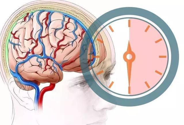 急性腦卒中發病幾小時可以溶栓（腦卒中從入院到溶栓）4