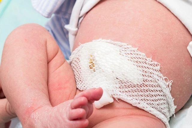 新生兒臍帶的護理及異常情況處理（關于新生寶寶臍帶護理那些事）2