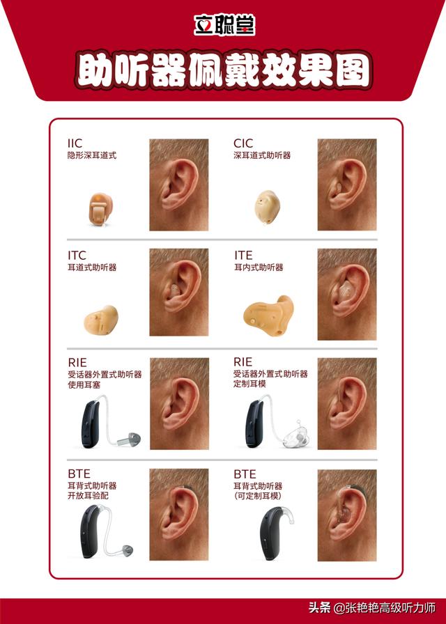 助聽器佩戴哪種效果好（助聽器該怎麼選）4
