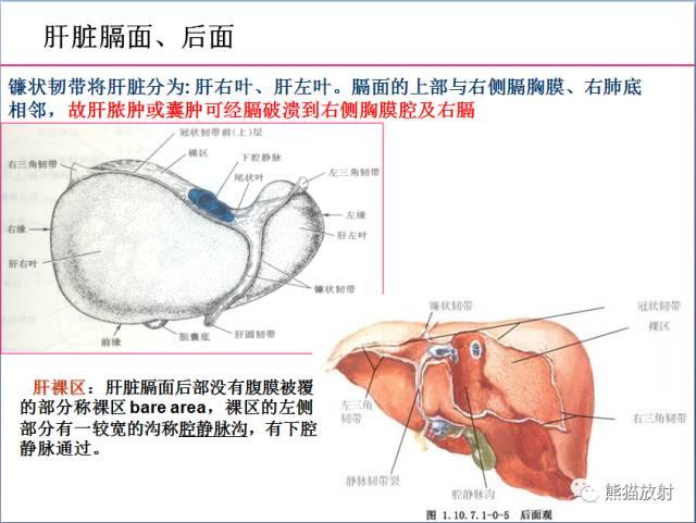 肝總管ct解剖位置（收藏上腹部CT斷層）2
