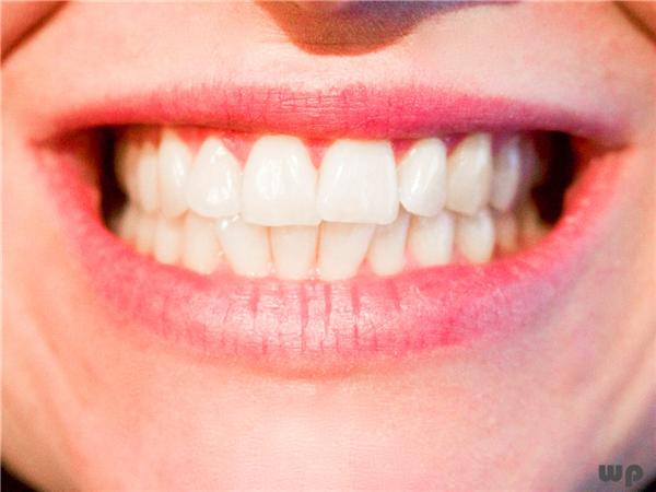 牙齒美白方法3種牙膏