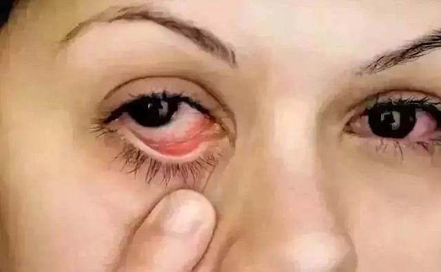 左眼皮上眼皮跳是什麼預兆（健康左眼跳财）6