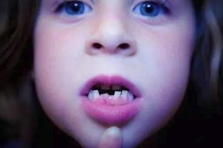 孩子磨牙就是肚子有蟲嗎（孩子睡覺磨牙就是肚子長蟲了嗎）3