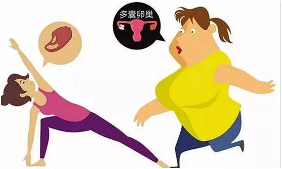 多囊卵巢綜合者如何減肥（為什麼多囊卵巢綜合征患者一定要減肥）3