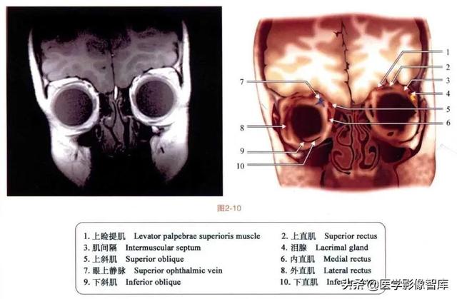 ct與mri斷層解剖學袖珍圖譜電子版（眼眶MRI斷層解剖速查圖譜）11
