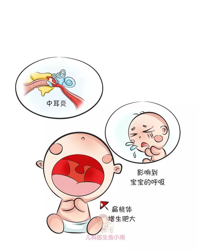 為什麼寶寶好好的就扁桃體發炎了（寶寶扁桃體老發炎）9