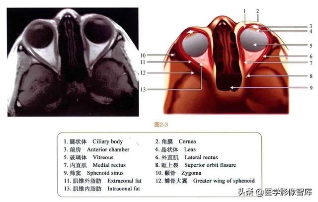 ct與mri斷層解剖學袖珍圖譜電子版（眼眶MRI斷層解剖速查圖譜）4