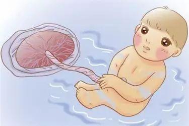 有前置胎盤的寶媽會有什麼症狀嗎