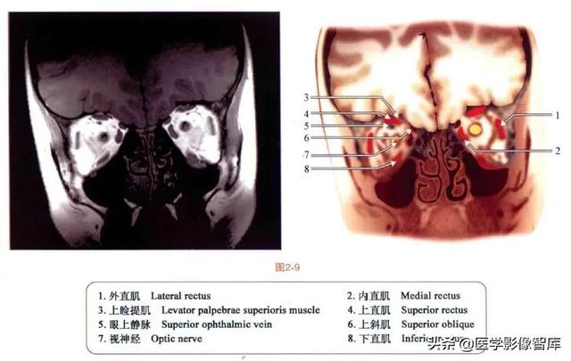 ct與mri斷層解剖學袖珍圖譜電子版（眼眶MRI斷層解剖速查圖譜）10