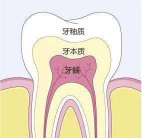 為什麼牙齒那麼容易變黑（你的牙齒為什麼會變黑）1