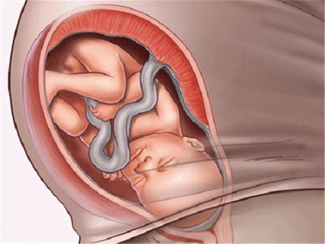 懷孕36周宮縮厲害是要生了嗎（懷孕36周的孕婦有宮縮現象）4