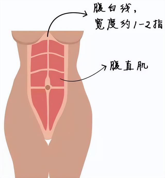 女性肚子上有一條淺色線（女生肚子上為啥都有一條褐色的線）3