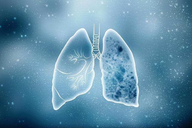 一般得了肺癌晚期能活多久（患者會經曆什麼）1