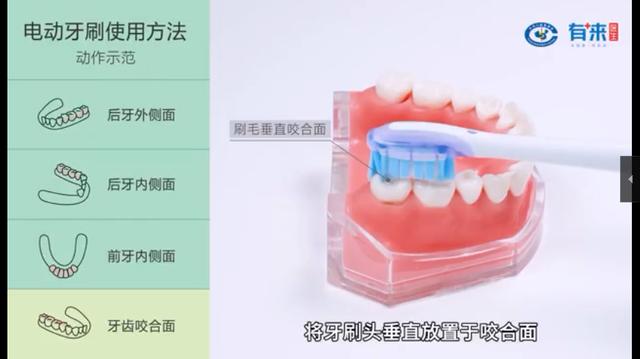 怎樣使用電動牙刷才能保護牙齒（牙科護理小知識）4