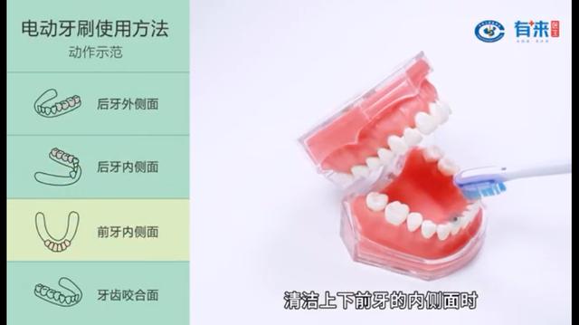 怎樣使用電動牙刷才能保護牙齒（牙科護理小知識）3
