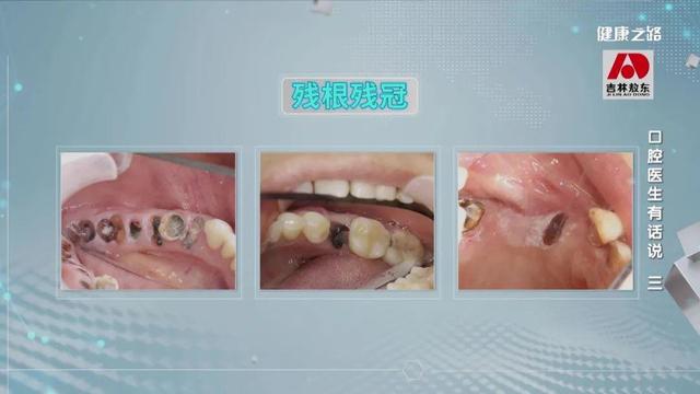 口腔粘膜癌會出現哪些症狀（口腔黏膜發生這些變化）4